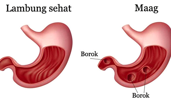 3 Kebiasaan Makan yang Rusak Lambung Tanpa Disadari