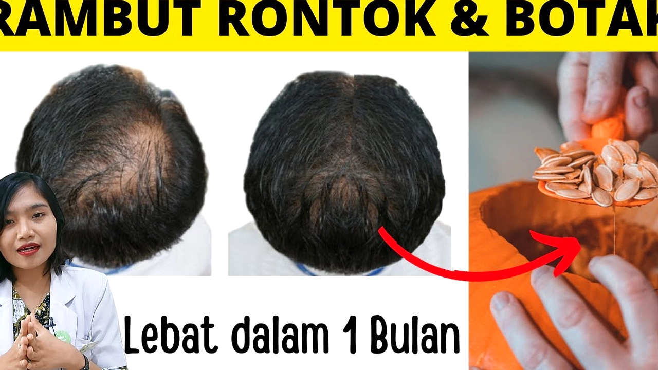 7 Makanan Alami Atasi Rambut Rontok