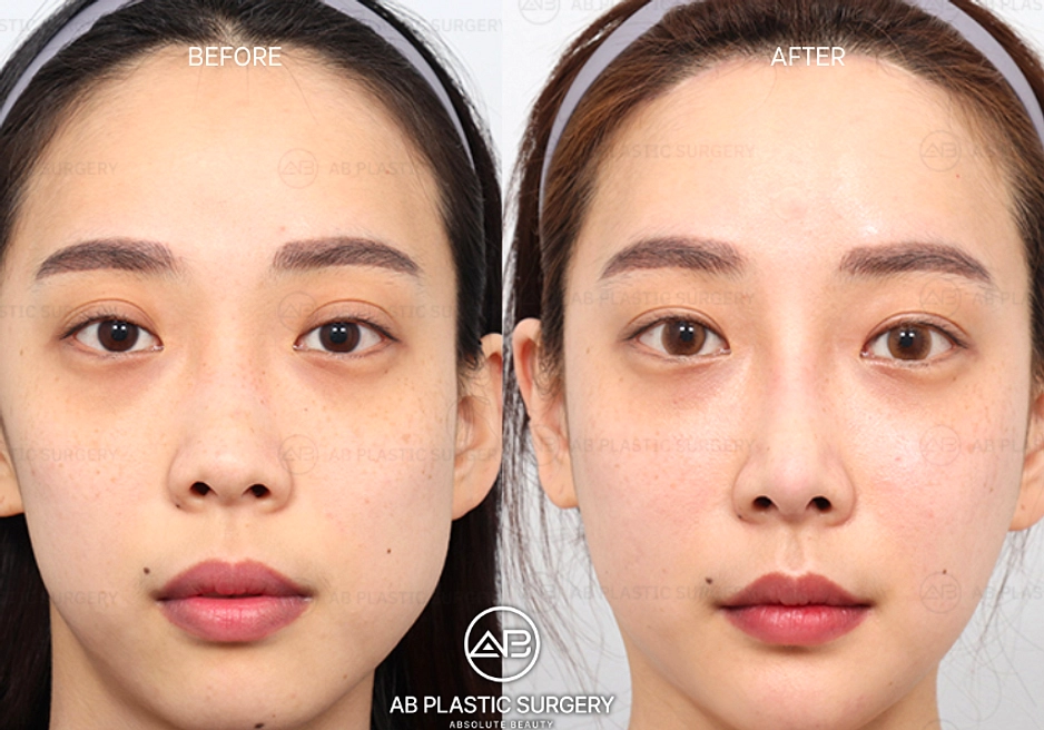 AB Plastic Surgery Menjadi Tuan Rumah IFAAS 2026 di Jakarta