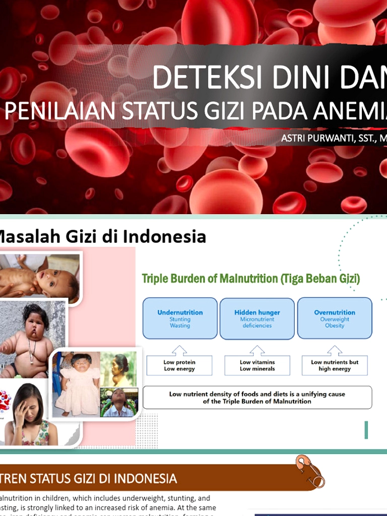 AI Deteksi Anemia Lewat Pemindaian Mata, Tanpa Jarum Suntik
