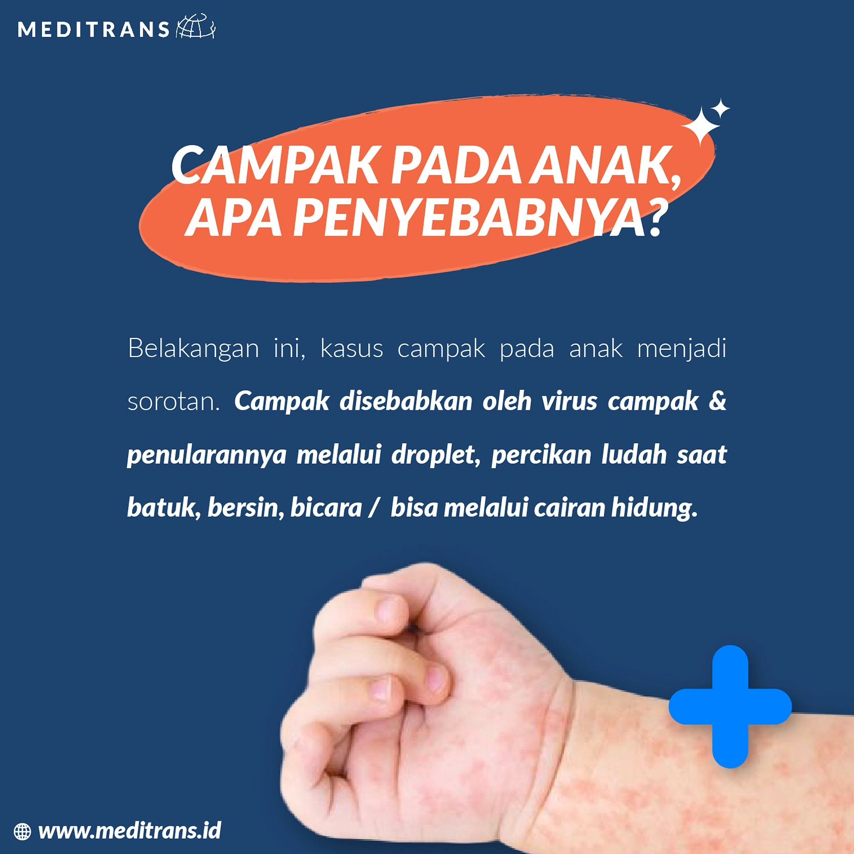 Anak 7 Tahun Meninggal Akibat SSPE, Menekan Vaksinasi MMR