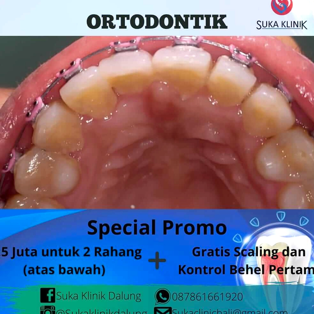 Bali: Pilihan Klinik Gigi bagi Wisatawan di Pulau