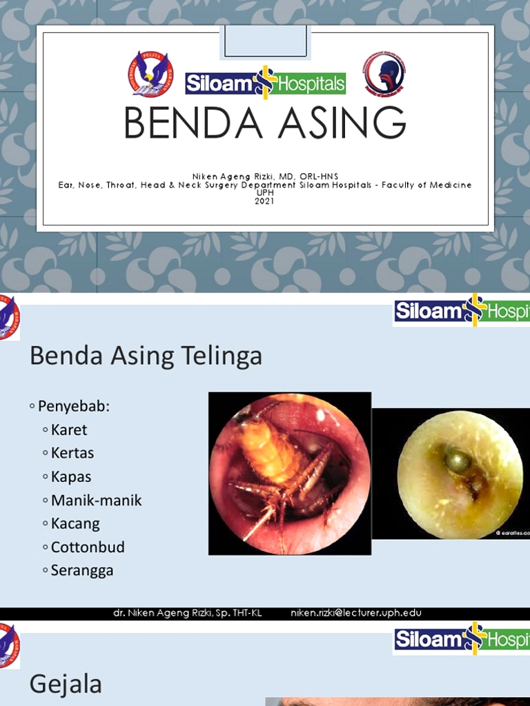 Bulu Mata Palsu Bersarang di Telinga Wanita Inggris, Sakit Kepala Hilang