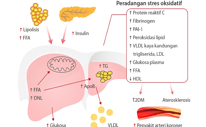 Diet Seimbang, Kunci Mengatasi Resistensi Insulin 2026