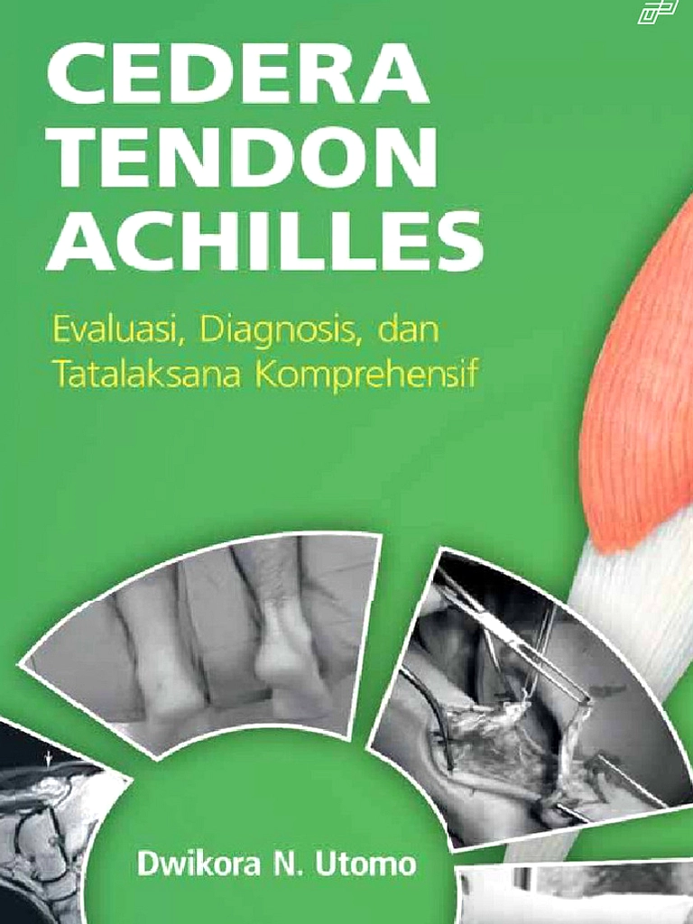 Ekitike Cedera Tendon Achilles, Tak Ikut Piala Dunia 2026
