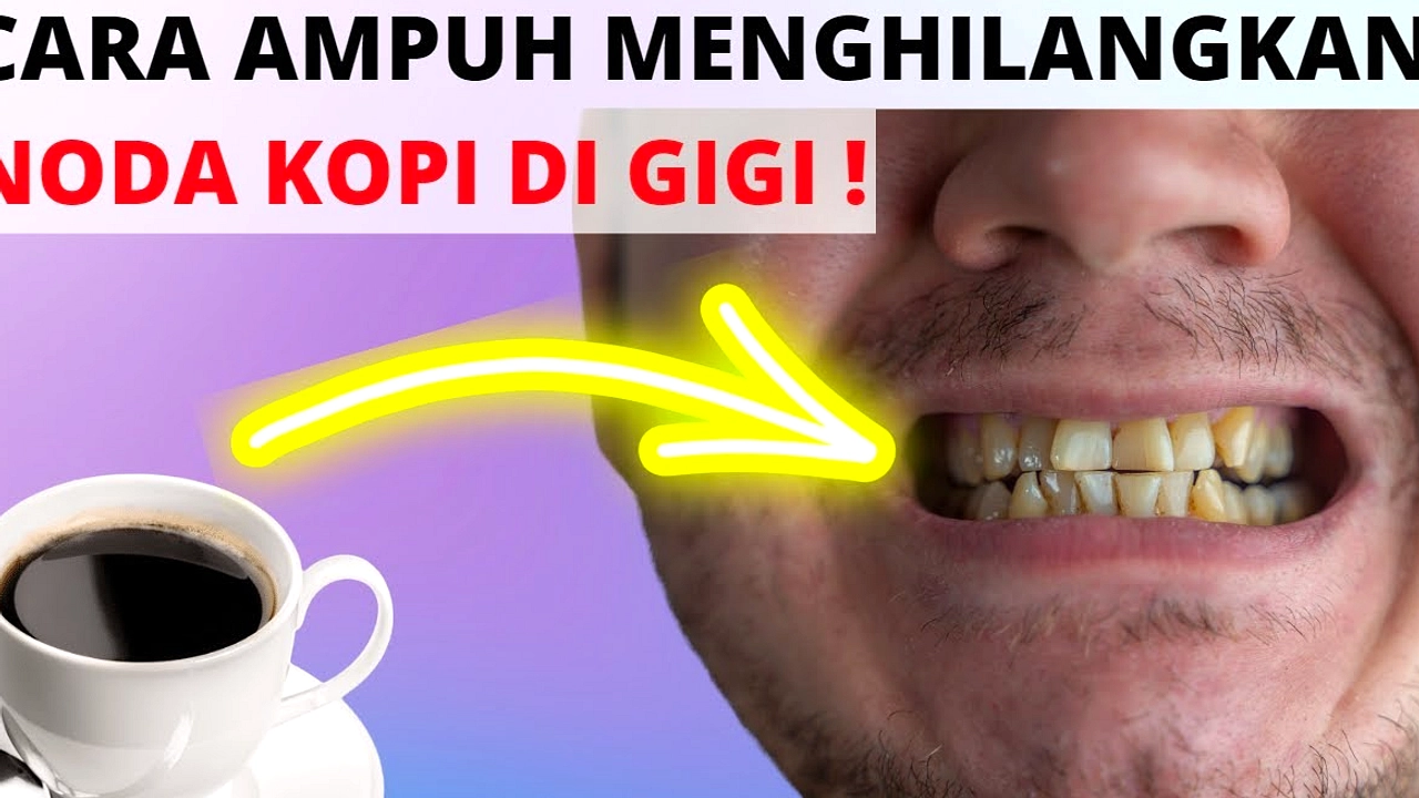 Es Kopi Berbisa: Minum Lambat Merusak Gigi + Gula Kandungan