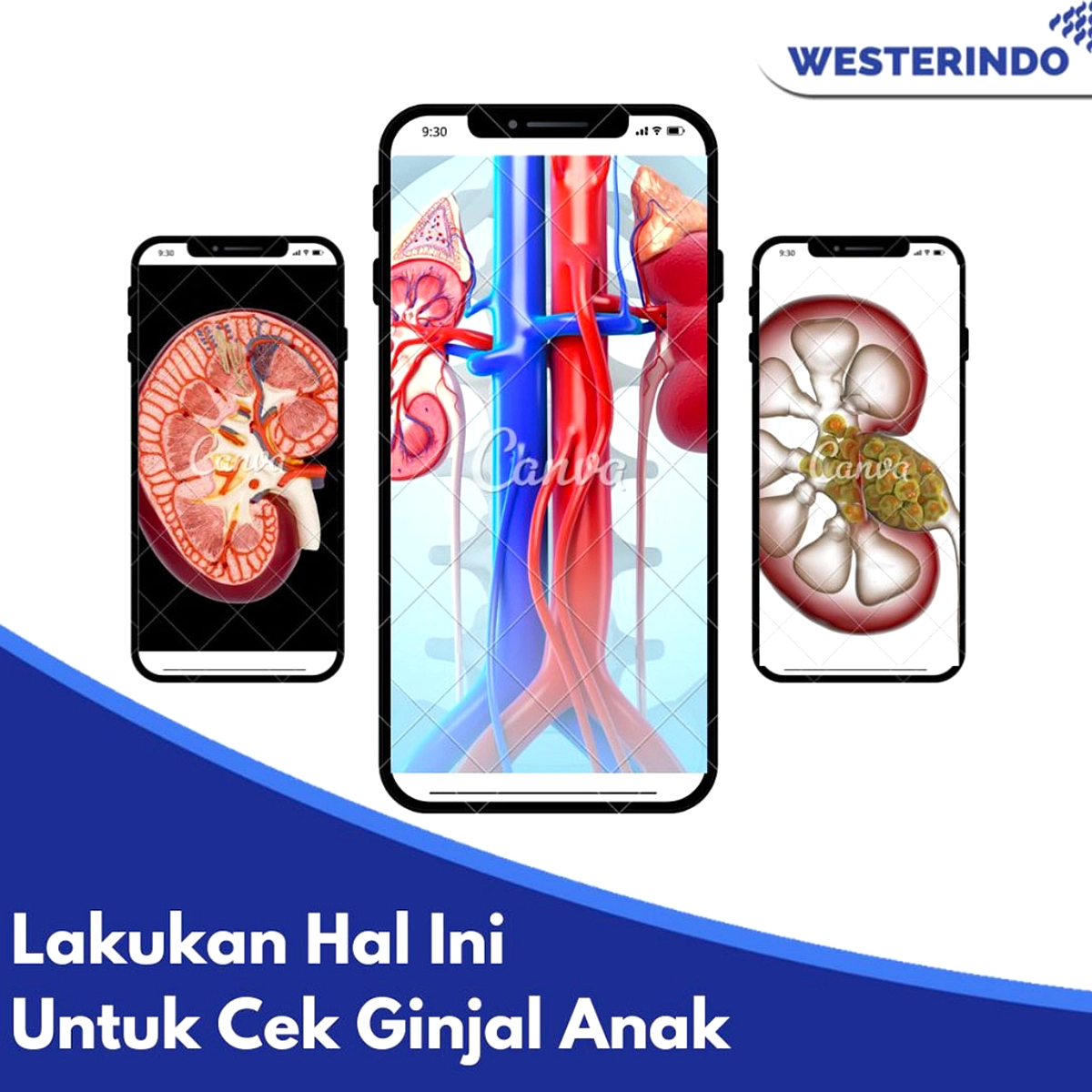 Ginjal Rusak Akibat Rhabdomyolysis, Bisakah Pulih?