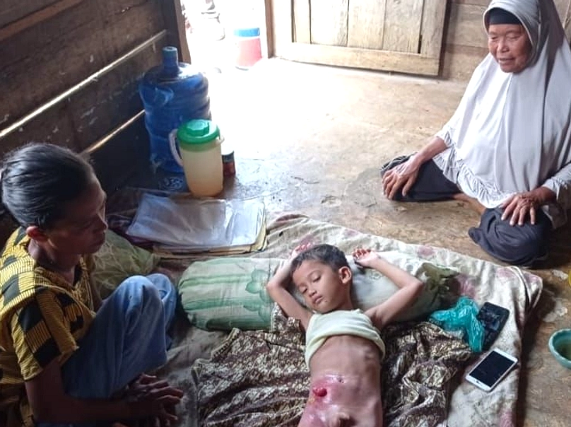 Gubernur Sumut Tindak Video Minta Bantuan Biaya Rumah Sakit
