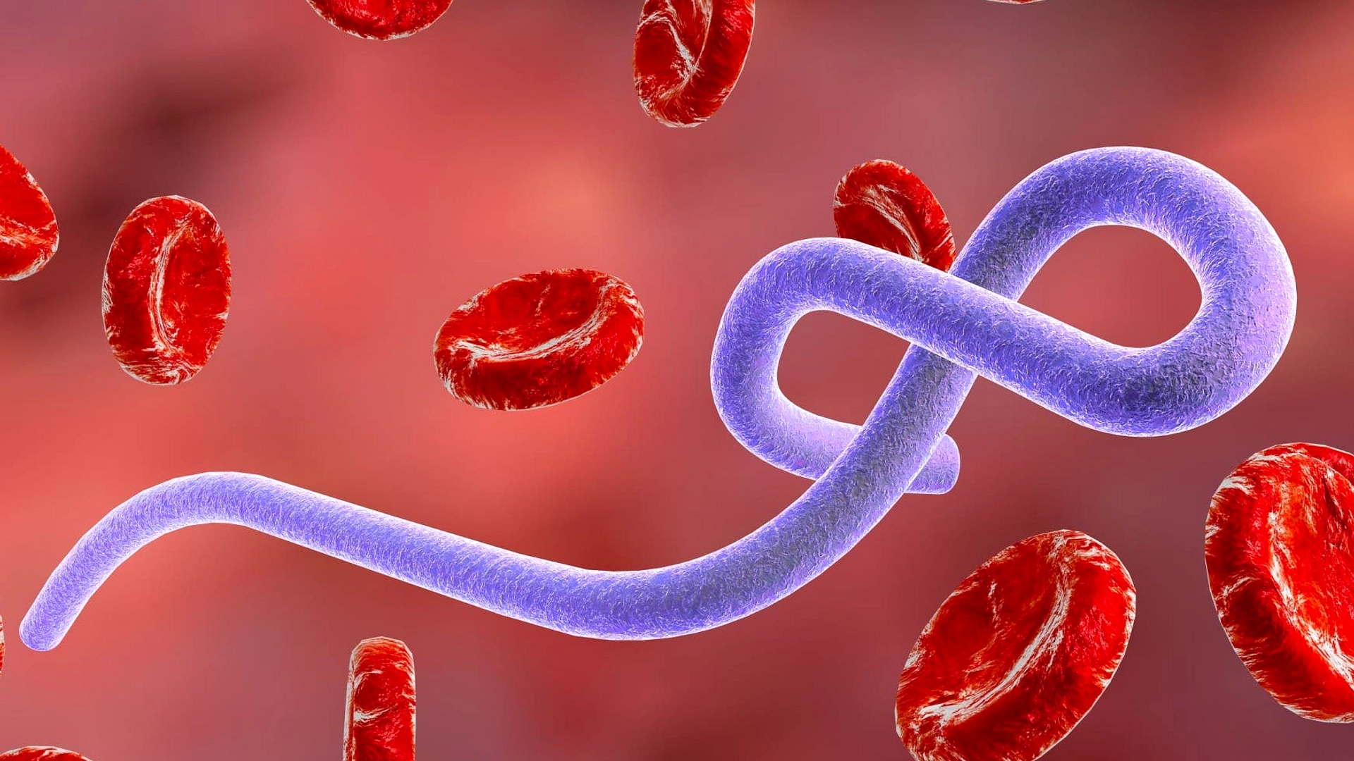 Indonesia Tidak Temukan Kasus Ebola, Tetap Waspada