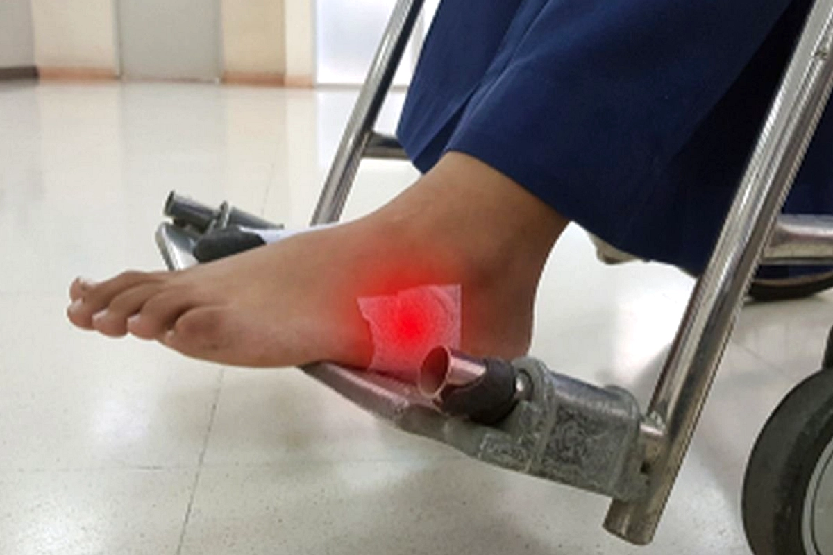 Luka Kaki Tak Sembuh? Waspada Ciri Diabetes