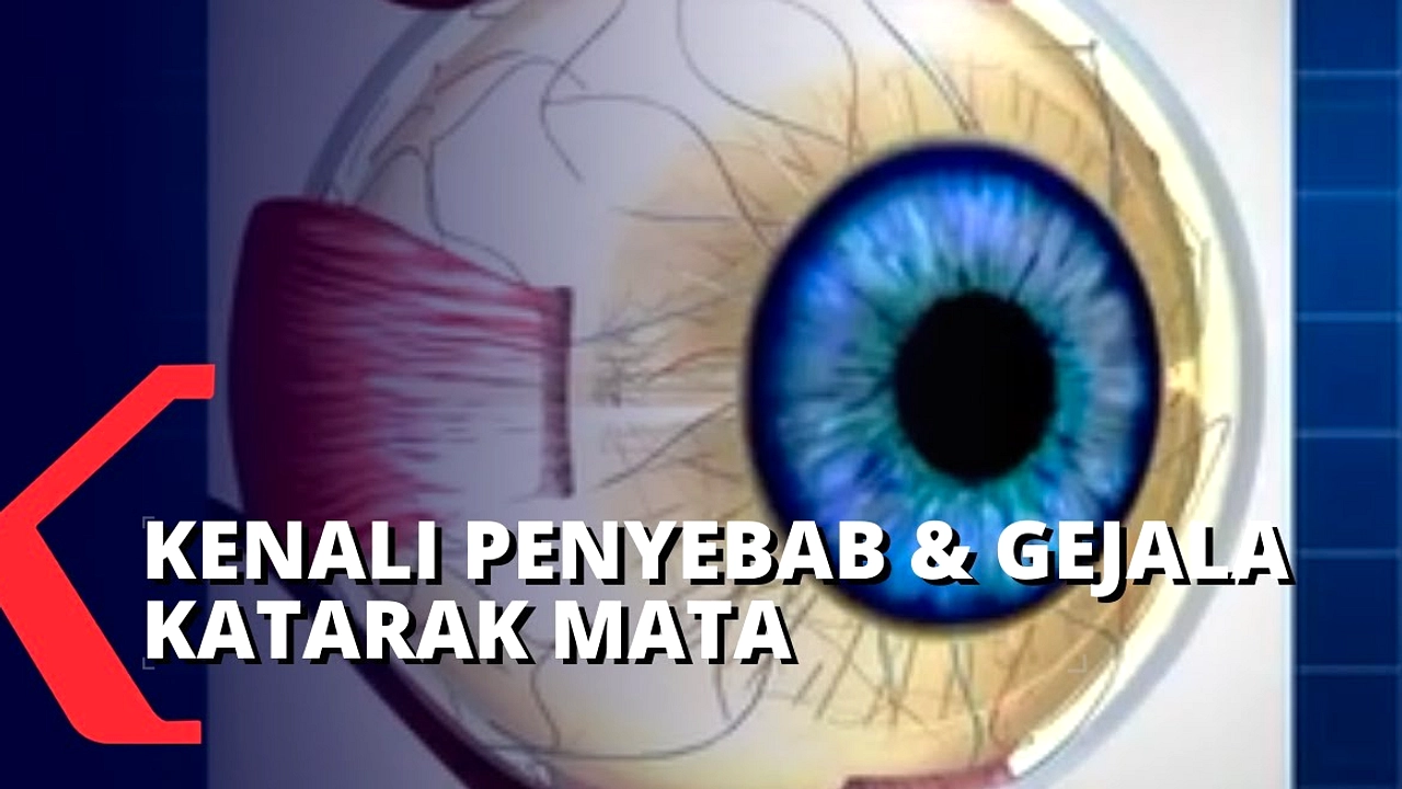 Mata Tua Kini Banyak Ditemukan pada Usia Lebih Muda