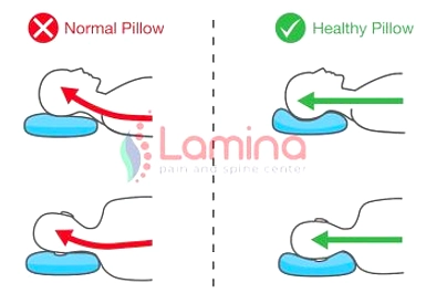 Menkes Budi: Posisi Bantal Leher yang Benar Saat Mudik