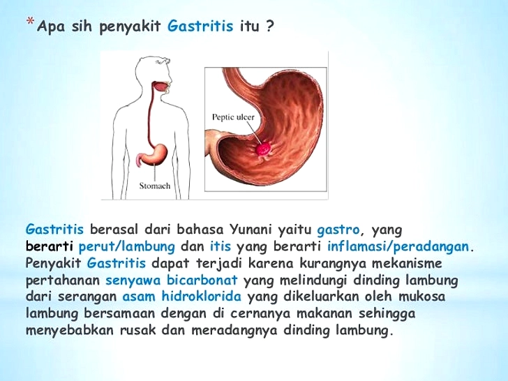 Miliarder Bryan Johnson Didiagnosis Lambung 'Memakan' Dirinya
