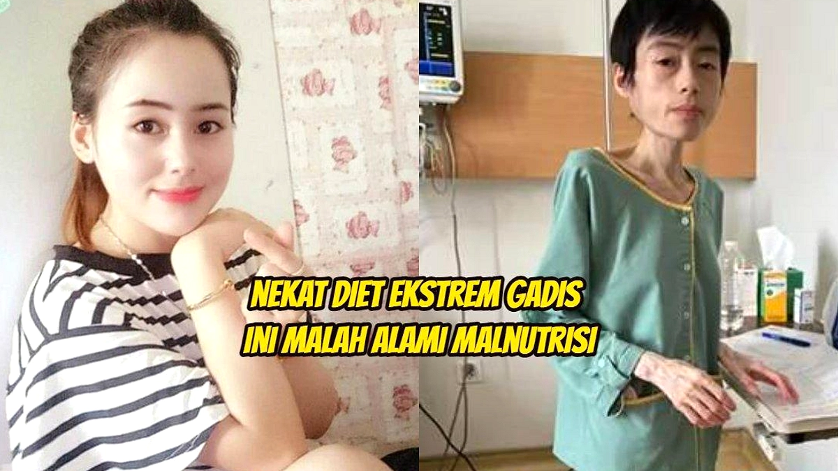 Pankreatitis Akut Pasien Diet Ekstrem, Berat Cepat Menyengat