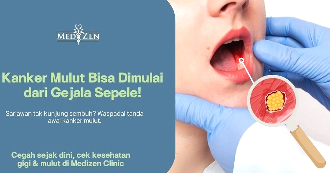 Penyakit Gusi Parah Terkait Penurunan Fungsi Ginjal