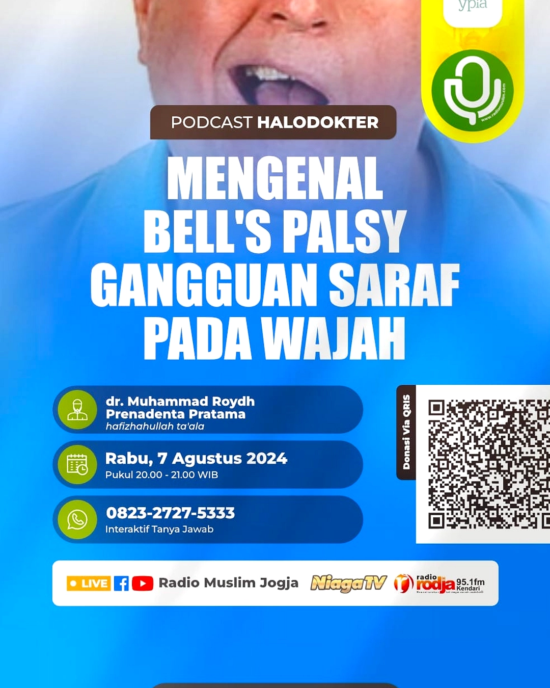 Pria TikTok Tampil Wajah Paling Membingungkan, Bell's Palsy