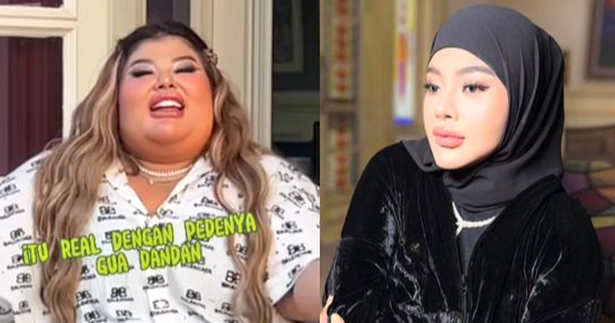 Shindy Samuel Turun 104 kg, Operasi Bariatrik Jadi Kunci