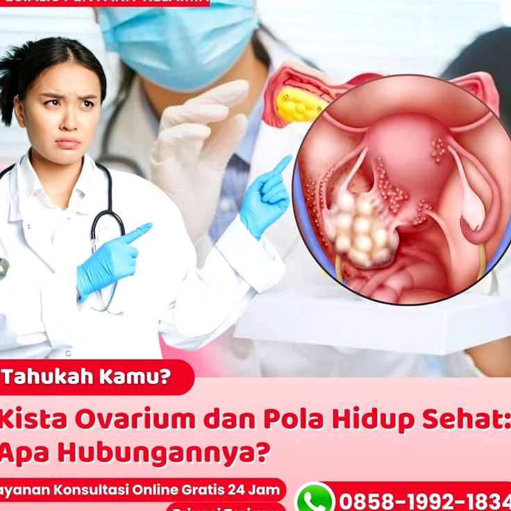 Siti Zahro, 23, Ditemukan Kista Ovarium 29 cm di Bekasi
