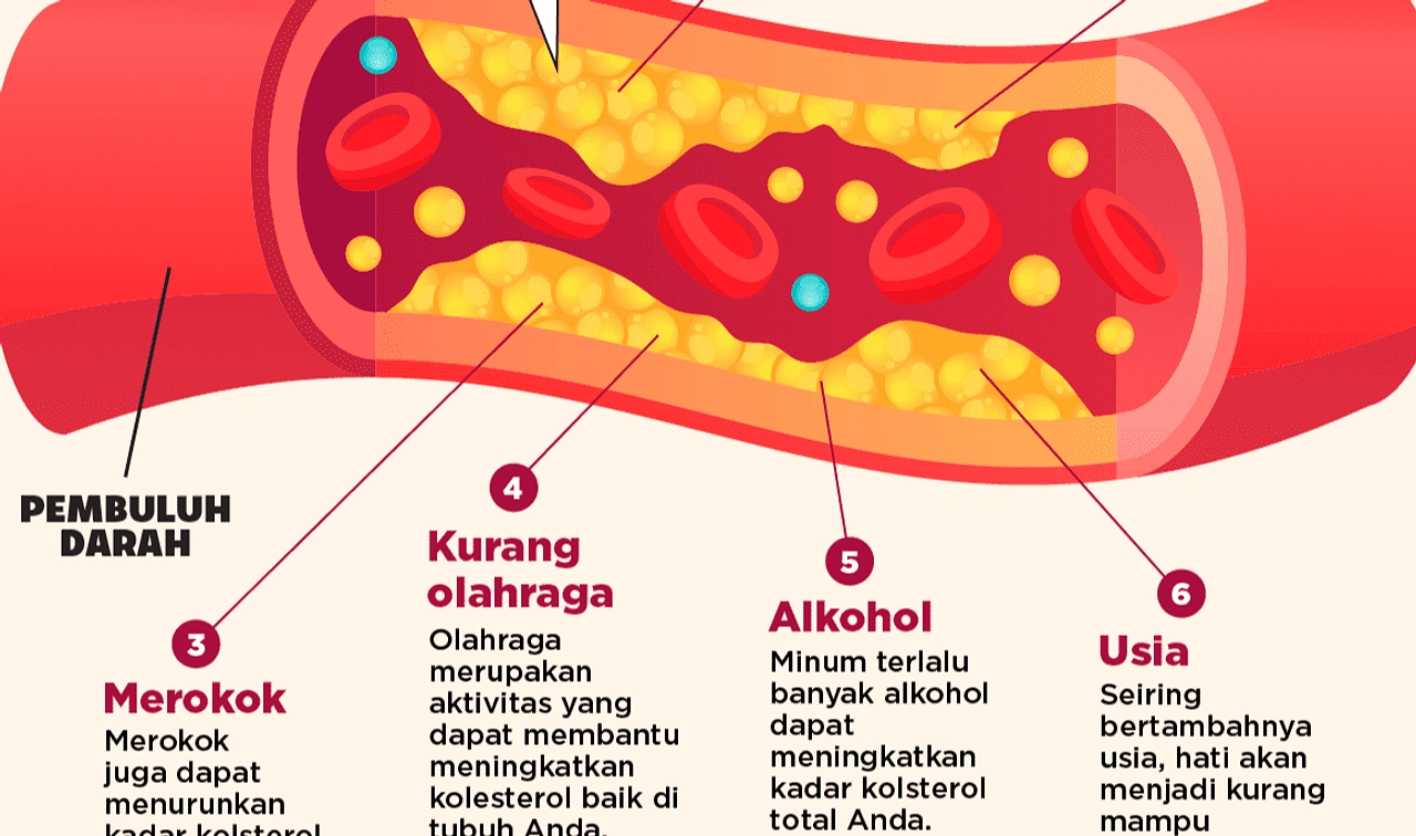 Tendon Achilles Menjadi Penanda Kolesterol Tinggi Kesehatan