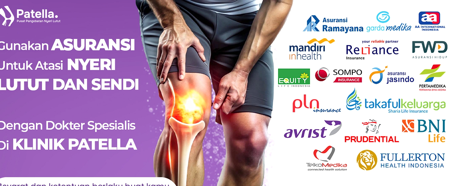 Tips Sederhana Atasi Kram Otot Saat Berlari dan Mendaki